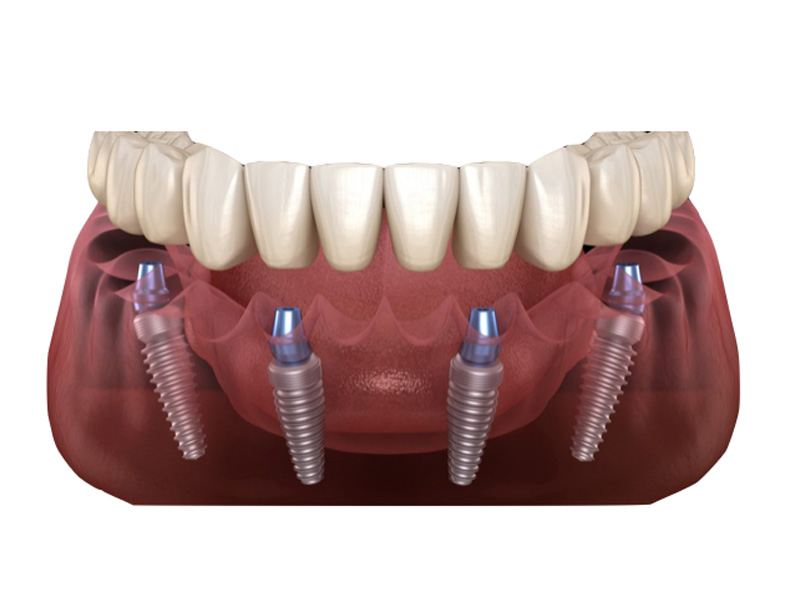 Arc Dental Roda