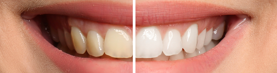 Calatrava Dental