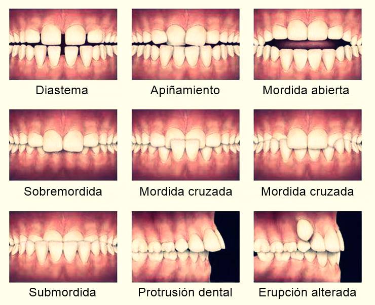 Clinica De Ortodoncia Del Noroeste