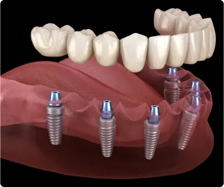 Clínica Dental Aldaz (Elgoibar)