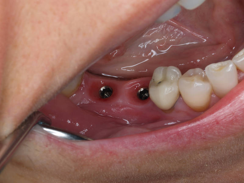 Clínica Dental Germán Cano Garófano
