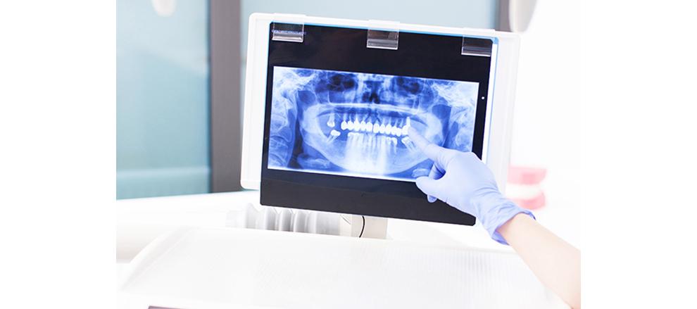 Clínica Dental Milenium Tres Cantos - Sanitas