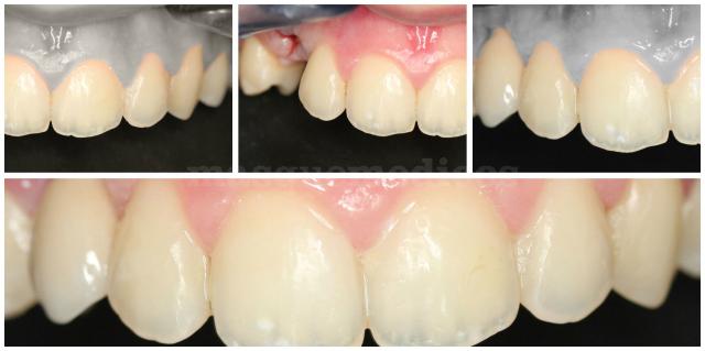 Clínica Dental Reina Victoria