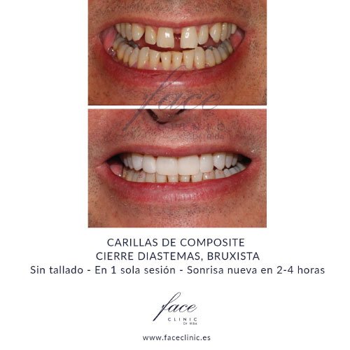 Clínica Estética Dental