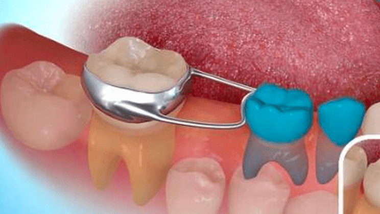 Espacio Dental