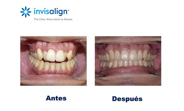 Clínicas Dentales En Torrijos