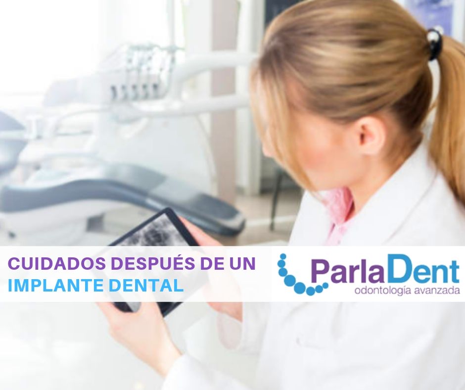 ParlaDent